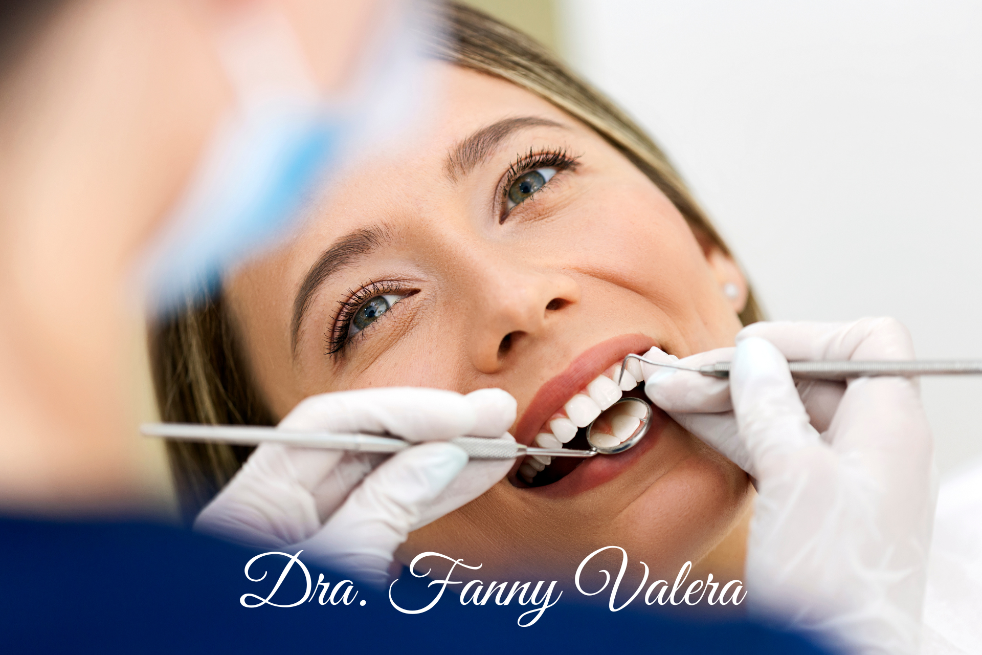 paquete carillas dentales de porcelana, paquete diseño de sonrisa carillas dentales de porcelana, smile design porcelain veneers, porcelain veneers package cartagena