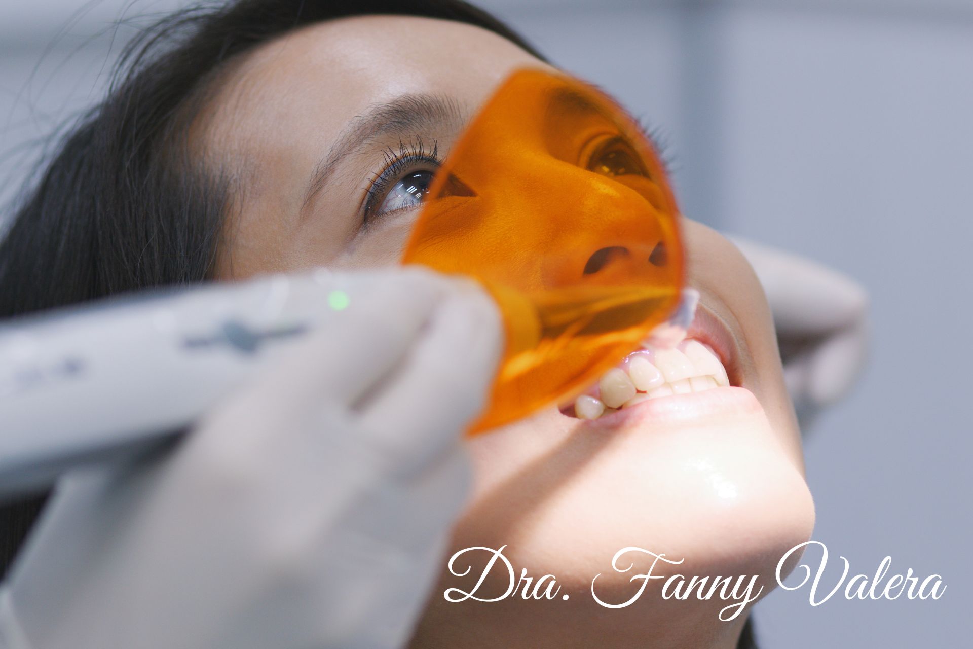 full teeth whitening, best teeth whitening, teeth whitening prices cartagena